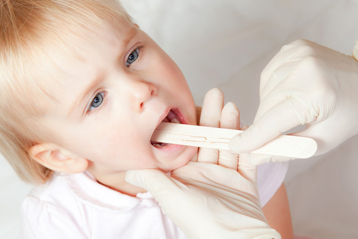 Viêm đường hô hấp kèm theo ho ở trẻ thời điểm giao mùa